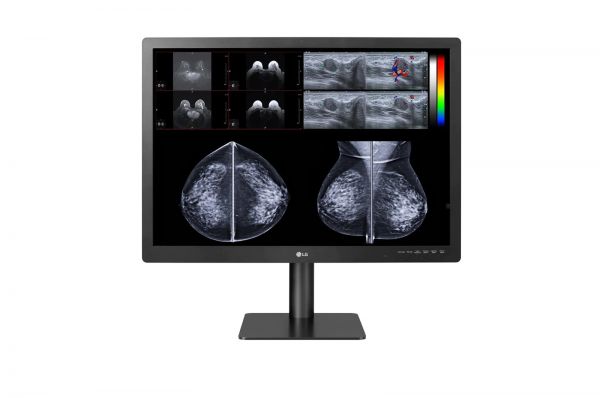 LG 31HN713D 31&#039;&#039; 12MP IPS Diagnostic Monitor for Mammography