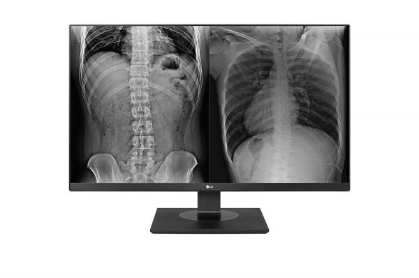 LG 27HJ713C 27&#039;&#039; 8MP Clinical Review Monitor